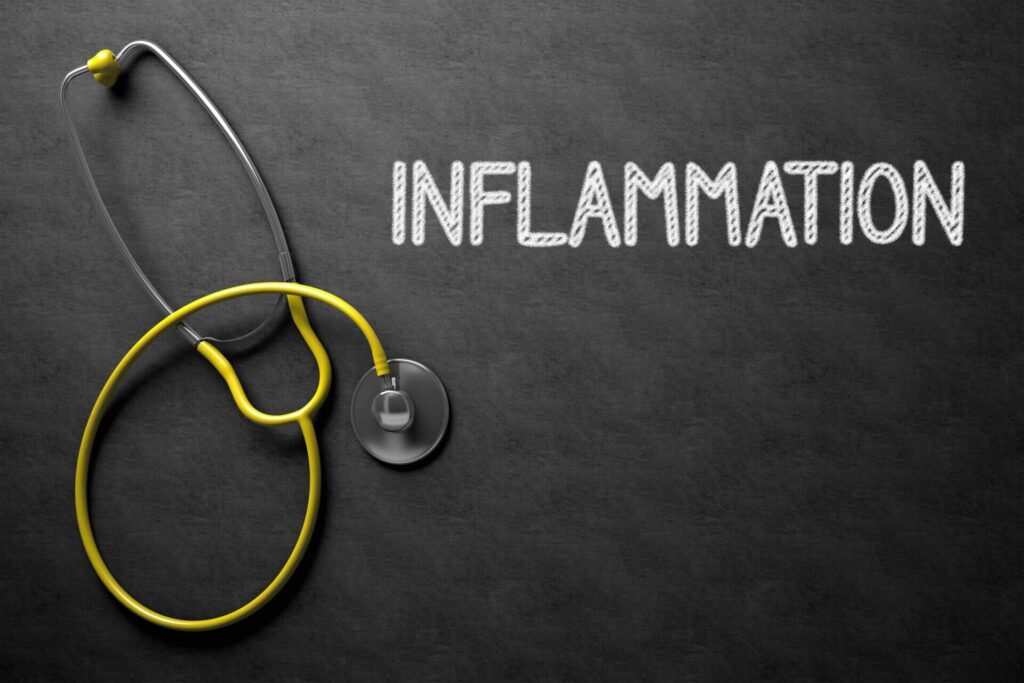 Flow Wellness offers multiple anti-inflammatory treatments.